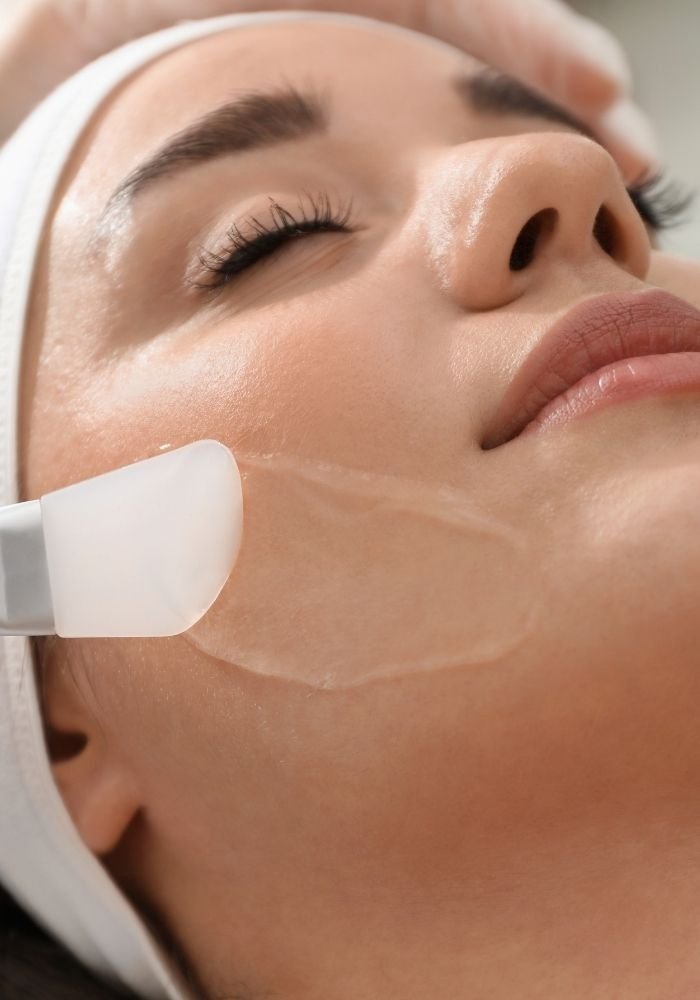 derma peels